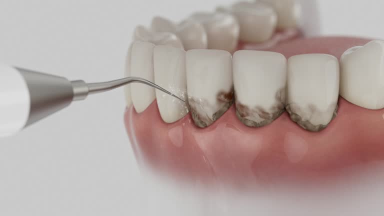 Trusted Teeth Cleaning And Checkup service in Lackawanna, NY - Dentist Open Now